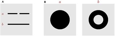 A Neural Network Model With Gap Junction for Topological Detection